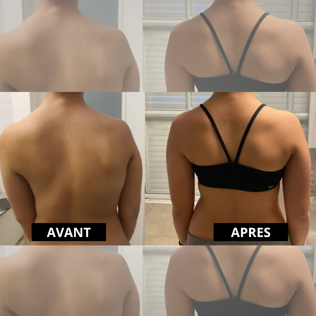 Correcteur de posture