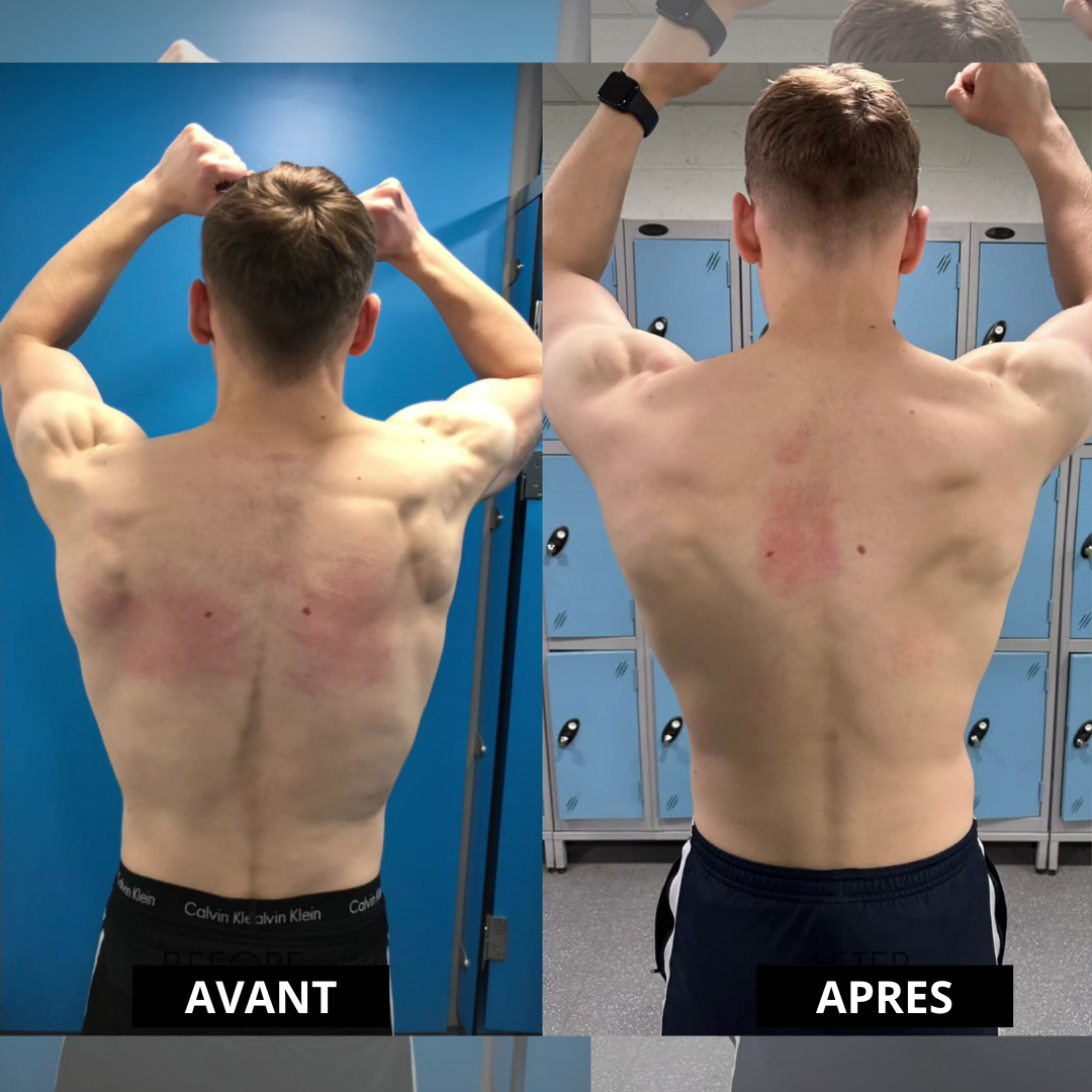 Correcteur de posture