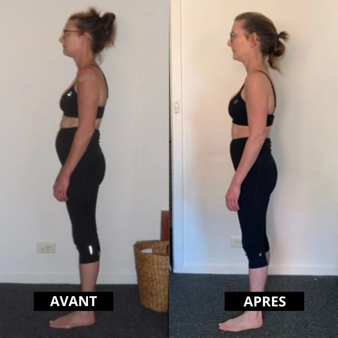Correcteur de posture